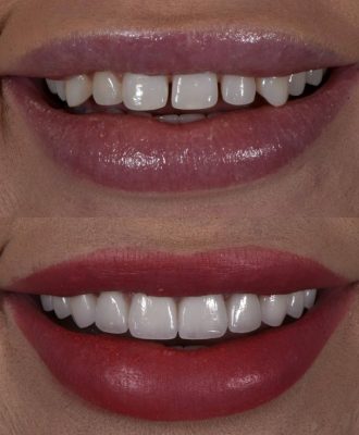 1a3be3d563099116c3c05c495ac46ef9