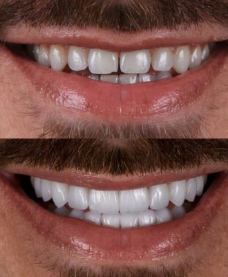 471f1fe05cc3ded04db889354d1a85bc