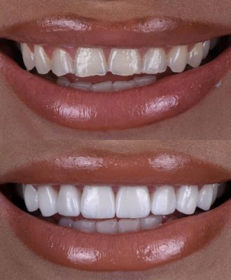 4fe141028c4904392fa79f4e0f2eed35