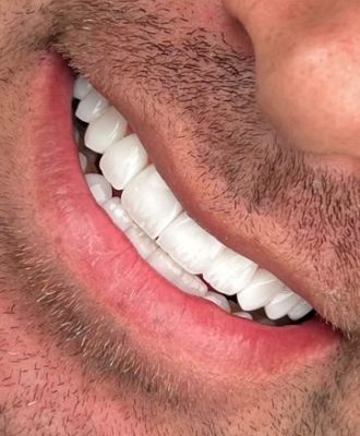 54394c6c8446a6e088450345cf123cac