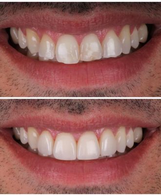 772c0ab27f0745fe80fcf9cb70513c09