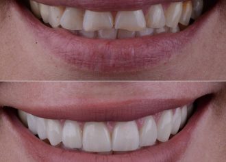 e94a38638512c685ed237ed9f8c72ae6